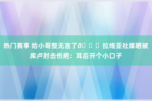 热门赛事 给小哥整无言了😅拉维亚社媒晒被库卢肘击伤疤：耳后开个小口子